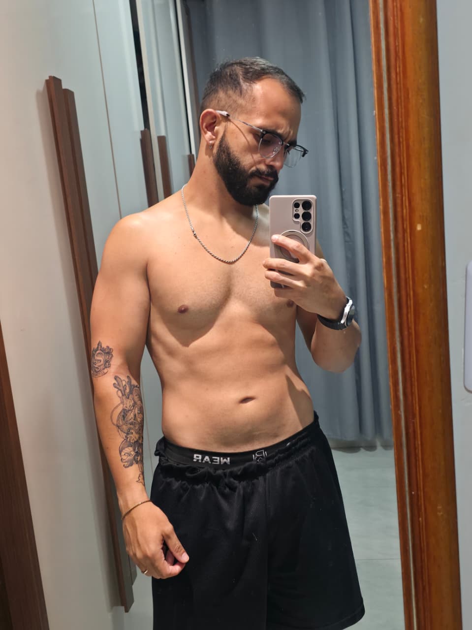 Depois - Hipertrofia